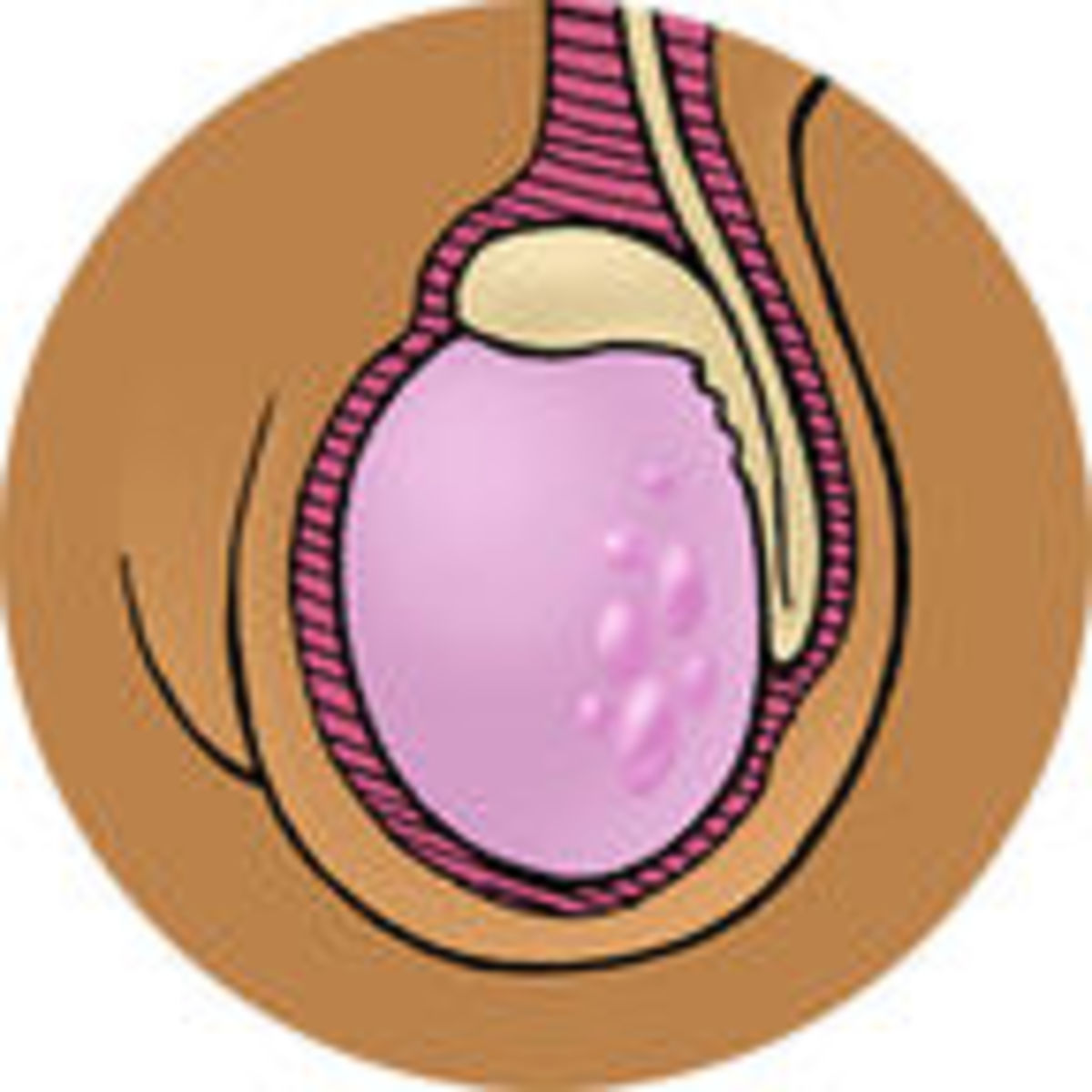 Ball Fondling Caption - How to Do a Testicle Exam, and Five Reasons Men Avoid Them ...