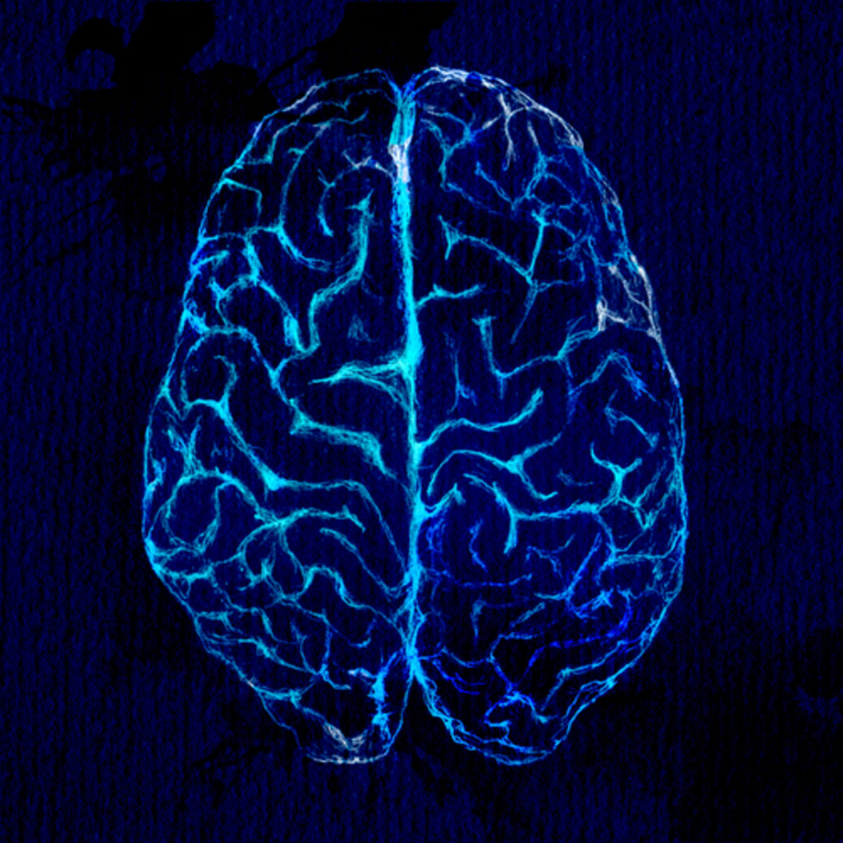 Social Stress Brain Circuitry Fails To >> How Chronic Stress Affects Neural Circuitry Psychology Today Social Stress Brain Circuitry Fails To >> How Chronic Stress Affects Neural Circuitry Psychology Today