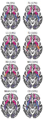 Alnæs et al., 2018 Alnæs et al., 2018