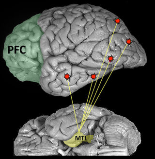 Brain image modified and reprinted with permission from Digital Anatomist Interactive Atlas, University of Washington, Seattle, WA, copyright 1997. Brain image modified and reprinted with permission from Digital Anatomist Interactive Atlas, University of Washington, Seattle, WA, copyright 1997.