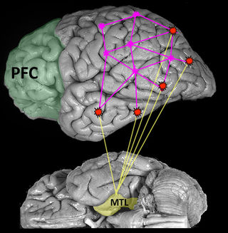 Brain image reprinted with permission from Digital Anatomist Interactive Atlas, University of Washington, Seattle, WA, copyright 1997.