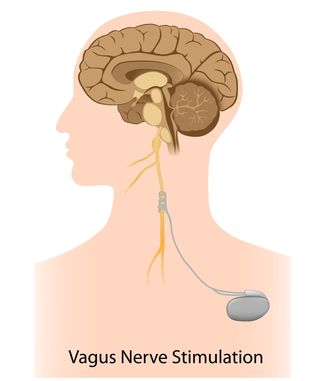 Alila Medical Media/Shutterstock Alila Medical Media/Shutterstock