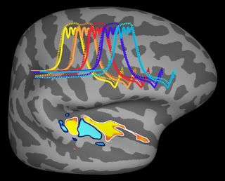 Courtesy of Conway lab, NIH Courtesy of Conway lab, NIH