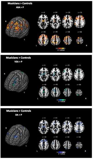 Kausel and coauthors, no usage restrictions with credit to Kausel et al./EurekAlert Kausel and coauthors, no usage restrictions with credit to Kausel et al./EurekAlert