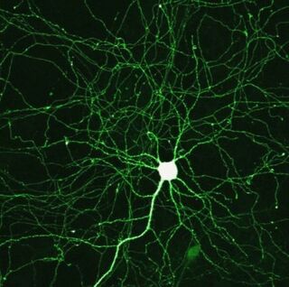 Neurons by Mike Seyfang/Flickr, CC by 2.0 Neurons by Mike Seyfang/Flickr, CC by 2.0