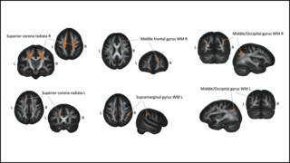 Molendowska aMatuszewski et al., JNeurosci 2021 Molendowska aMatuszewski et al., JNeurosci 2021