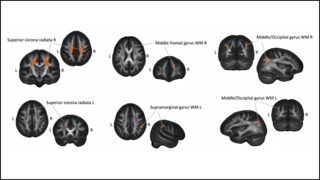 molendowment ska aMatuszewski等人，JNeurosci, 2021年