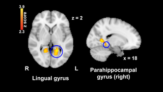Zhang et al., JNeurosci 2021 Zhang et al., JNeurosci 2021