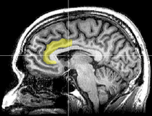 Anterior cingulate cortex