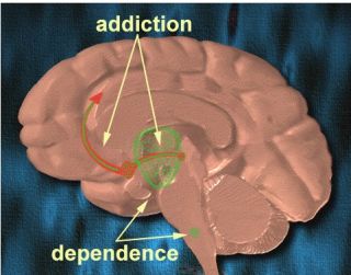 The addicted brain