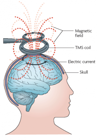 Transcranial Magnetic Stimulation (TMS) Depression | Psychology Today