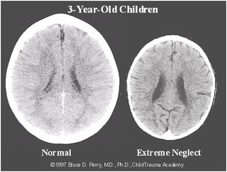 Perry & Pollard (1997) Proceedings from the Society for Neuroscience Annual Meeting (New Orleans). shared under fair use rules