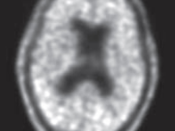 The Wisdom of the Sloth: Is Sleep a Lost Virtue? | Psychology Today