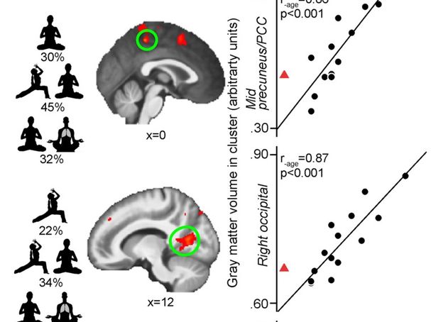 What Can 11 Hours of Meditation Training Do? It Can Rewire Your Brain ...
