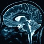 People with Extraordinary Autobiographical Memory