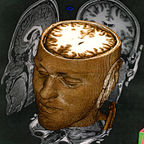 Time to throw out the DSM?