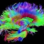 This Is Your Brain on Meditation