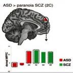 Diametric Mentalizing Imaged in Autistic & Psychotic Brains