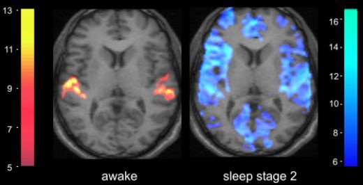 Sleep: The Clean-Up Crew of a Dirty Mind | Psychology Today
