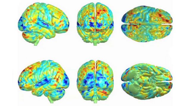 Music lights up the entire brain.