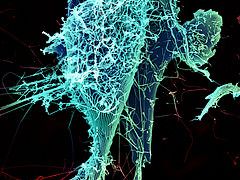 The Ebola Virus