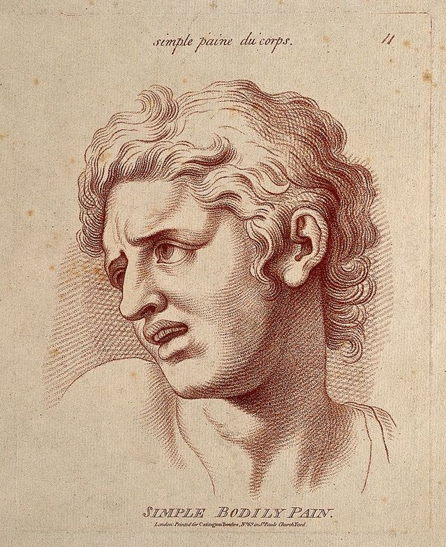 A man whose face expresses moderate pain/William Hebert/Wellcome Images/CC 4. A man whose face expresses moderate pain/William Hebert/Wellcome Images/CC 4.