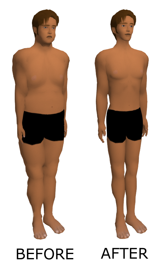 Weight loss worcestershire image 2