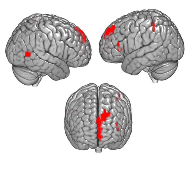 Can Artificial Intelligence Predict Suicide? | Psychology ...