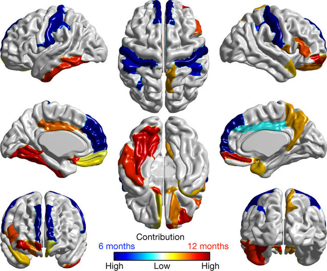 Brain Scans May Forecast Autism In High >> Early Brain Over Growth Is Indicative Of Autism As Predicted Brain Scans May Forecast Autism In High >> Early Brain Over Growth Is Indicative Of Autism As Predicted