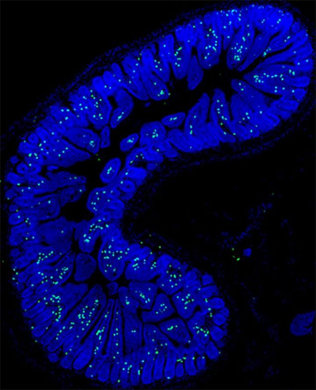 Courtesy of Iadecola lab, Weill Cornell Medicine, New York, N.Y. Courtesy of Iadecola lab, Weill Cornell Medicine, New York, N.Y.