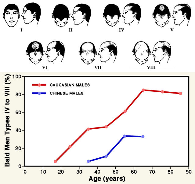 Adapted from figures in Hamilton (1951). Adapted from figures in Hamilton (1951).