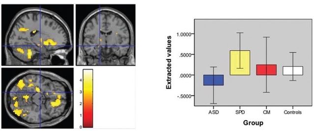 Schizophrenia Bulletin vol. 43 no. 6 pp. 1220–1228, 2017