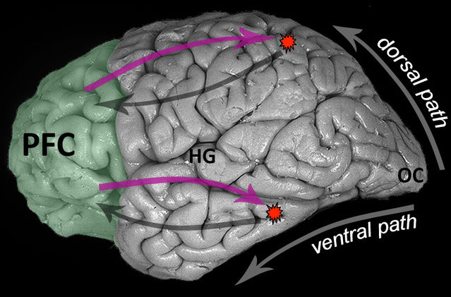 Brain image modified and reprinted with permission from Digital Anatomist Interactive Atlas, University of Washington, Seattle, WA, copyright 1997. Brain image modified and reprinted with permission from Digital Anatomist Interactive Atlas, University of Washington, Seattle, WA, copyright 1997.