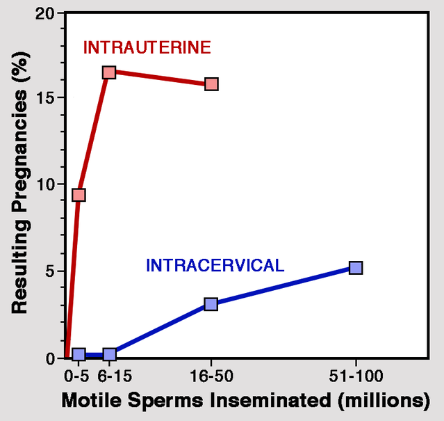 Comparison of pregnancy rates with intracervical insemination (ICI) and intrauterinal insemination (IUI). Rates are more than three times higher with IUI, and smaller numbers of motile sperms are needed than with ICI.