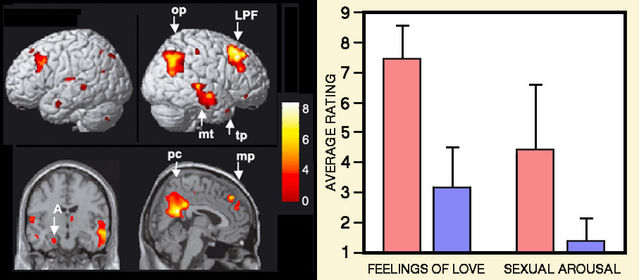 Image adapted and combined from Bartels & Zeki 2000 (right) and 2004 (left). Used with permission. Image adapted and combined from Bartels & Zeki 2000 (right) and 2004 (left). Used with permission.