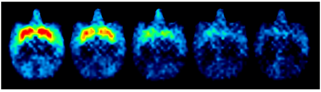 Image credited to Yukiko Hori from National Institutes for Quantum and Radiological Science and Technology Image credited to Yukiko Hori from National Institutes for Quantum and Radiological Science and Technology