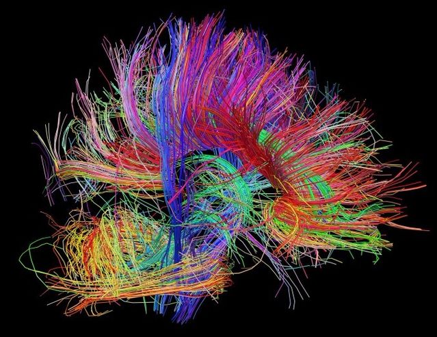 Courtesy of Human Connectome Project Courtesy of Human Connectome Project