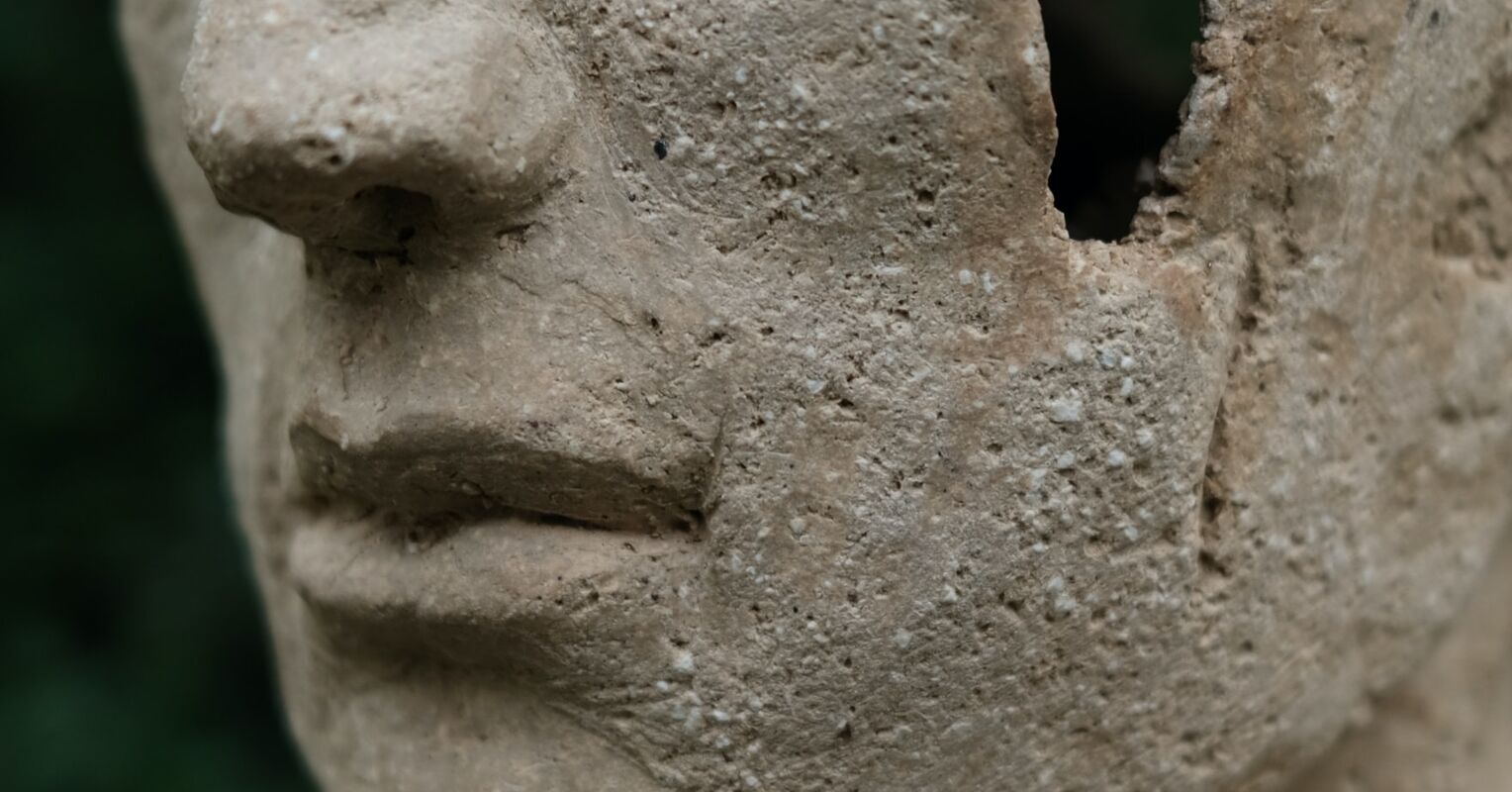 Why Are People Biased Against Anomalous Facial Features? | Psychology ...