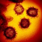 新型冠状病毒SARS-CoV-2